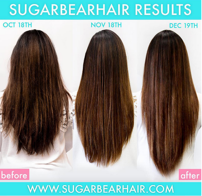 sugarbearhair vitamins ผลิตภัณฑ์วิตามินบำรุงเล็บ บำรุงผม sugarbearhair vitamins ผลิตภัณฑ์วิตามินบำรุงเล็บ บำรุงผม